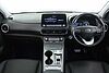 Hyundai KONA 150kW Ultimate 64kWh 5dr Auto Green